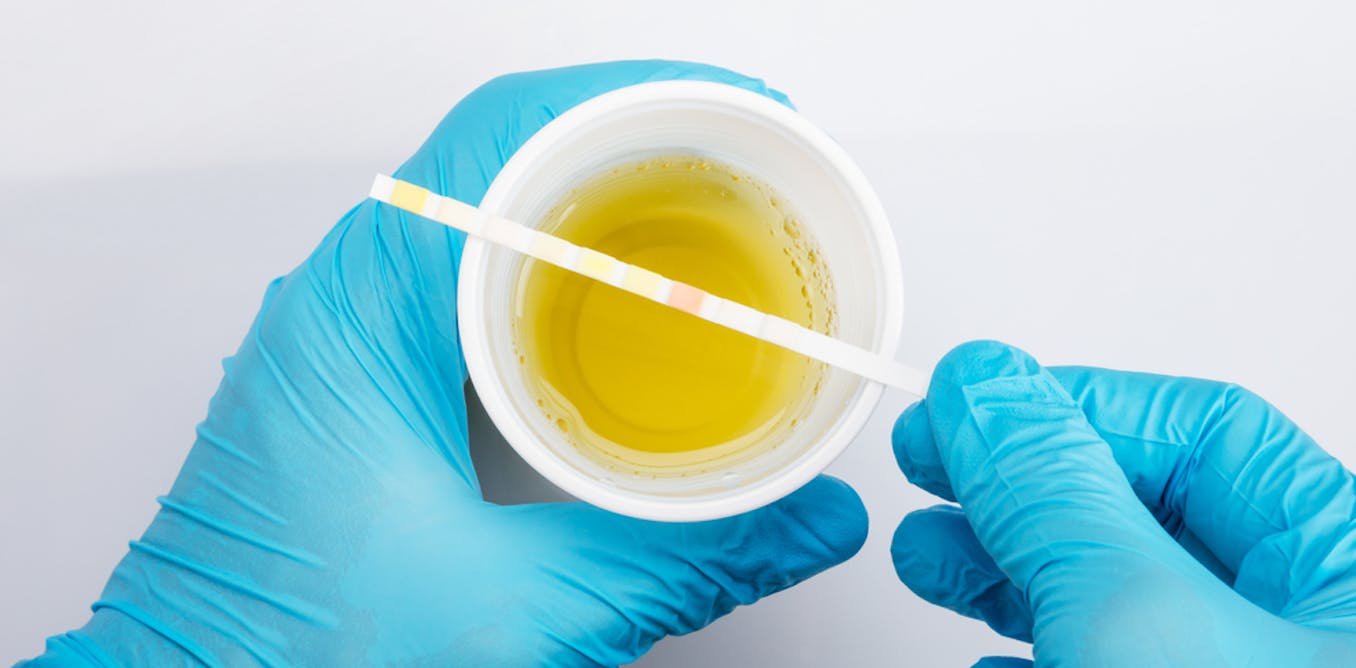 urine culture test report sample